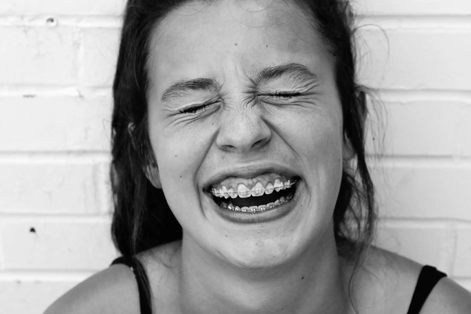 sourire gingival