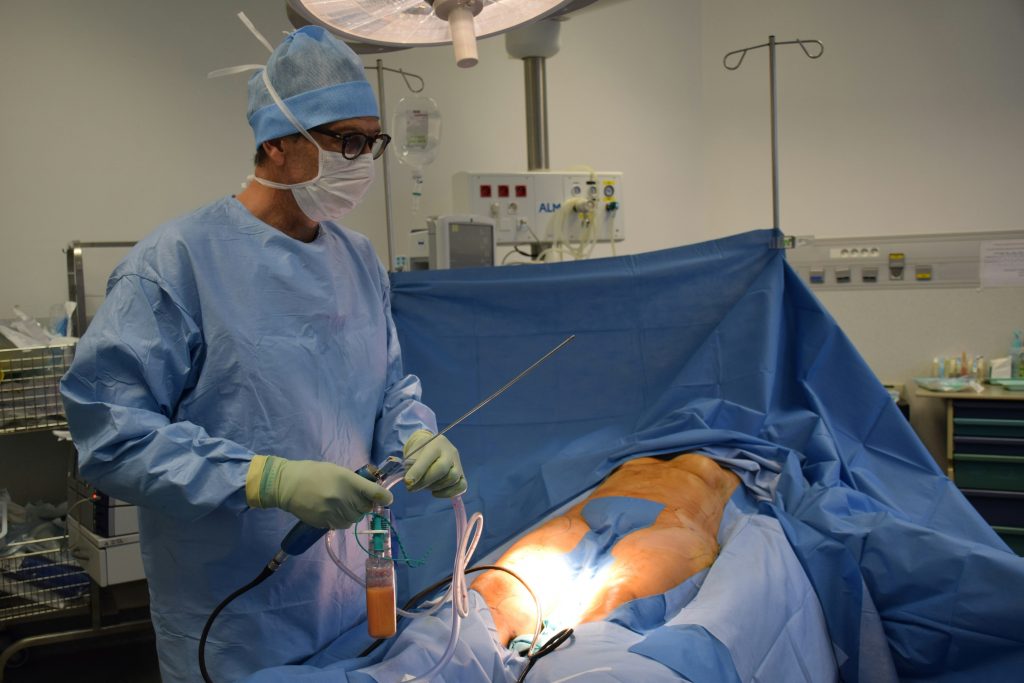 culotte de cheval liposuccion