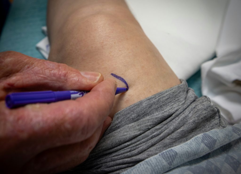 intervention veine saphène