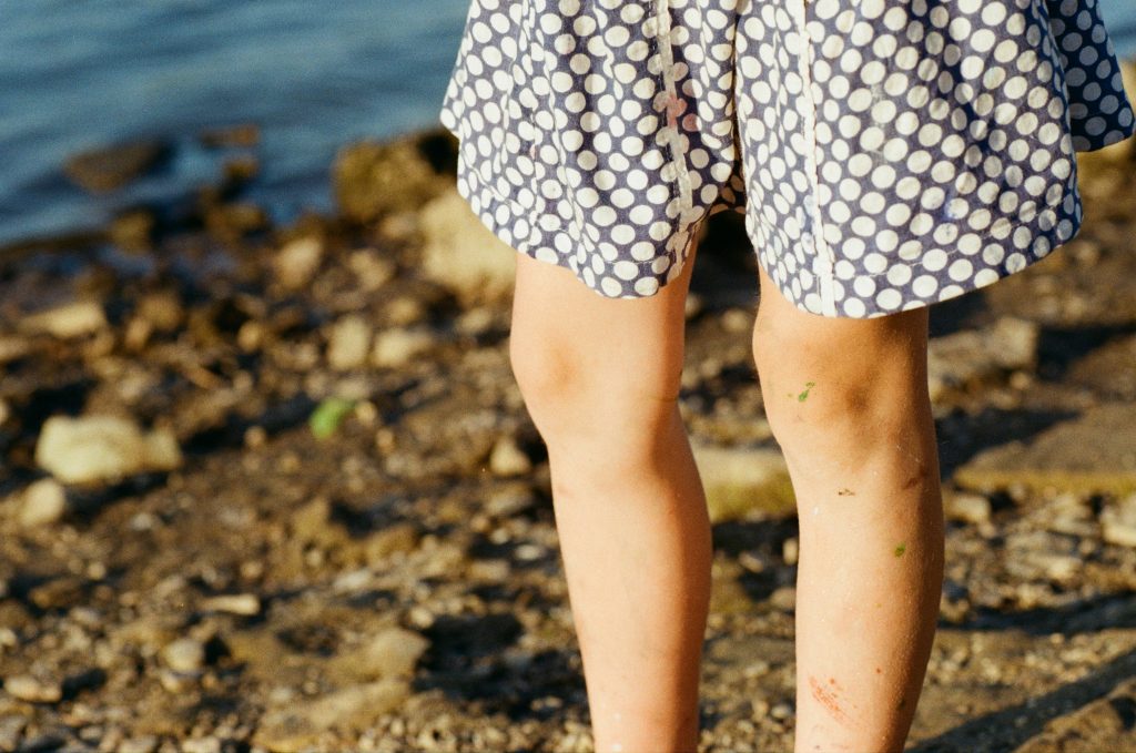 après injection acide hyaluronique genou​