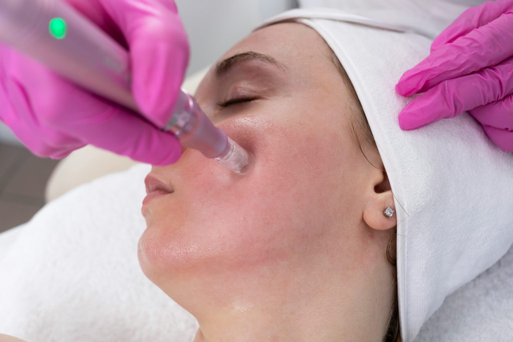 hydrafacial avis
